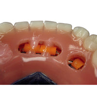Acrifix Kuss Dental - KIT Résine Photopolymérisable Sceller ou Réparer