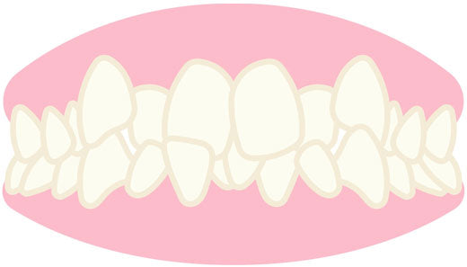 Occlusion Dentaire Naturelle ou Prothétique - Les Bases de Notre Santé