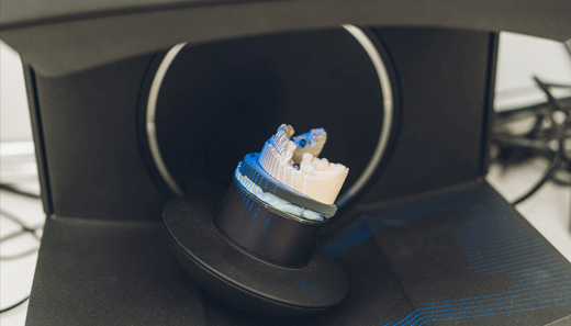 CAD/CAM technology in dental prosthesis