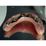 Acrifix Kuss Dental - Specler de kit de resina fotopolimerizável ou reparo