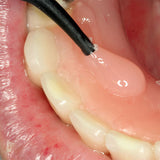 ACRIFIX KUSS Dental - Specler o reparación del kit de resina fotopolimerizable