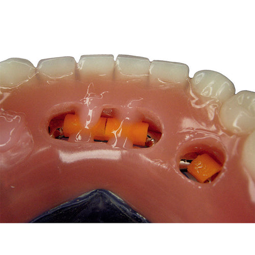 Acrifix Kuss Dental - Seringue 3 gr Résine Photo Rose.