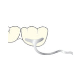 Hook j right molar scheu dental