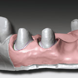 Gingifast CAD Elastic Zhermack 2x50 ml für falsche Zahnfleisch Zherkt.