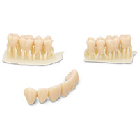 Dima dientes estampados kulzer dima resina - puentes impresión de coronas.