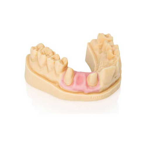 resine-3d-dima-gingiva-rose