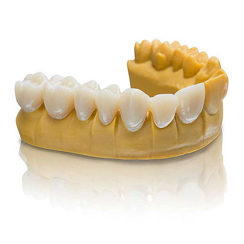 varseosmile temporary crown bego