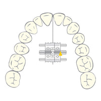 Vector 200 - cilindro ortodontico dentale Scheu