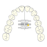 Vector 200 - Vérin Orthodontique Scheu Dental