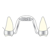 Vector 600 - Scheu Dental Palatal Expansion Actuator