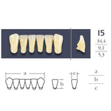 Cross Linked 2 teeth 2 anterior low - shape i5 vita shades of your choice
