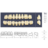 Denti trasversali collegati posteriori T4 - scelta alta o bassa